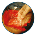 MAST-BioSURGERy™_2-300x300